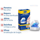 Dispositivo De FotoTerapia Ultra Violeta FreshNail - Tratamento Eficiente Para Doenças e Fungos De Unhas [QUEIMA DE ESTOQUE ULTIMAS UNIDADES - 50% De Desconto]