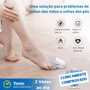 Dispositivo De FotoTerapia Ultra Violeta FreshNail - Tratamento Eficiente Para Doenças e Fungos De Unhas [QUEIMA DE ESTOQUE ULTIMAS UNIDADES - 50% De Desconto]