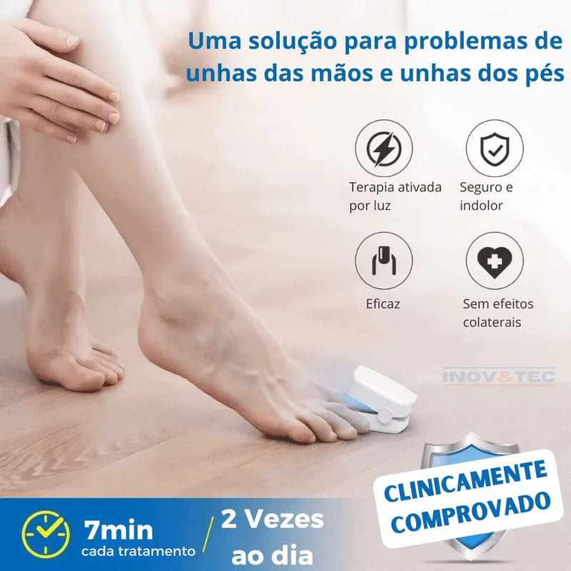 Dispositivo De FotoTerapia Ultra Violeta FreshNail - Tratamento Eficiente Para Doenças e Fungos De Unhas [QUEIMA DE ESTOQUE ULTIMAS UNIDADES - 50% De Desconto]