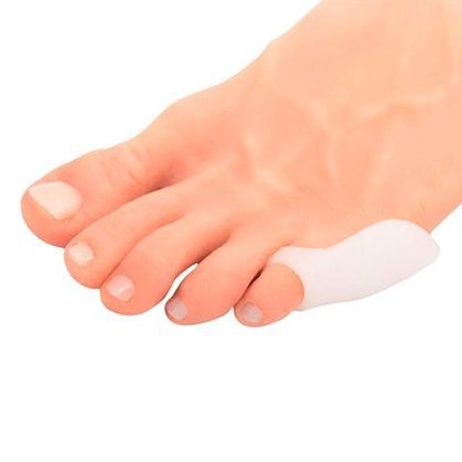 Corretor Protetor Ortopédico de Dedão em Silicone para Bunionette e Joanete