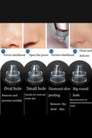 Aparelho Removedor de Cravos a Vácuo - MicroDerm