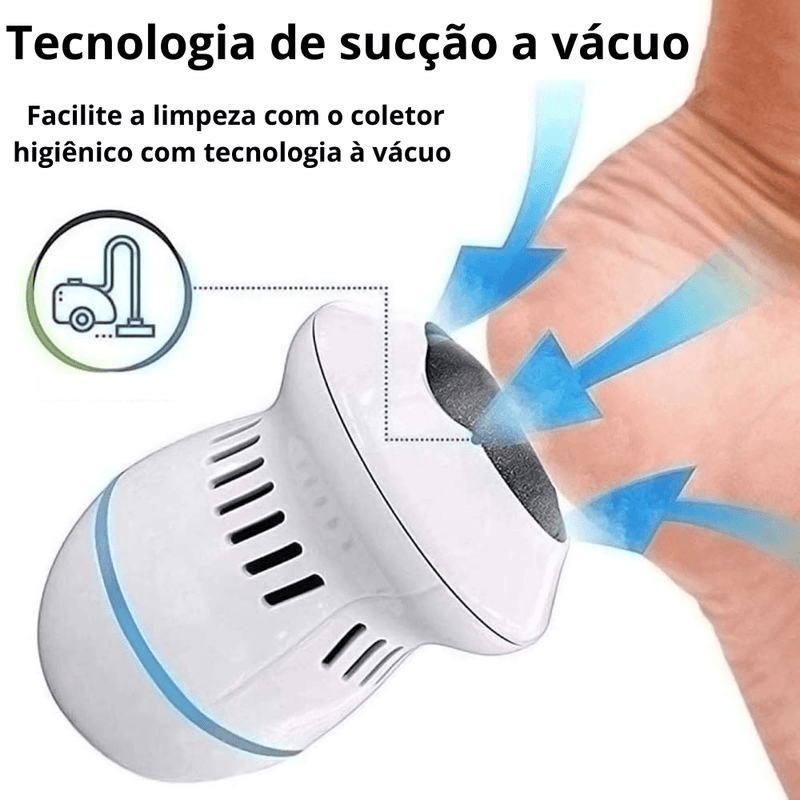 Removedora de Calos e Rachaduras dos Pés SOFT FOOT + Refil - Inov&tec