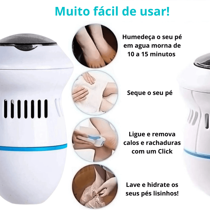 Removedora de Calos e Rachaduras dos Pés SOFT FOOT + Refil - Inov&tec