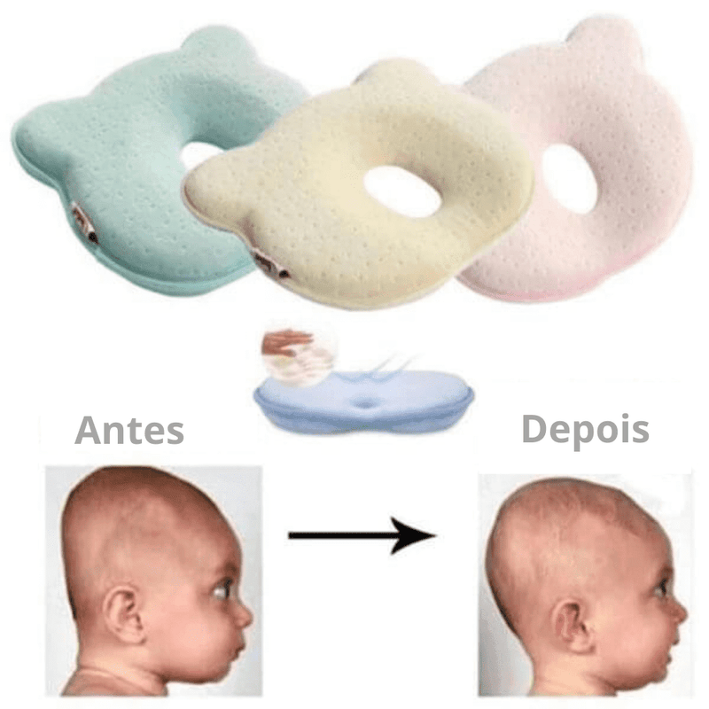 Travesseiro Para Bebê Que Corrige e Previne Plagiocefalia (Anti Cabeça Achatada) - ROUND HEAD - Inov&tec