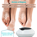Removedora de Calos e Rachaduras dos Pés SOFT FOOT + Refil - Inov&tec