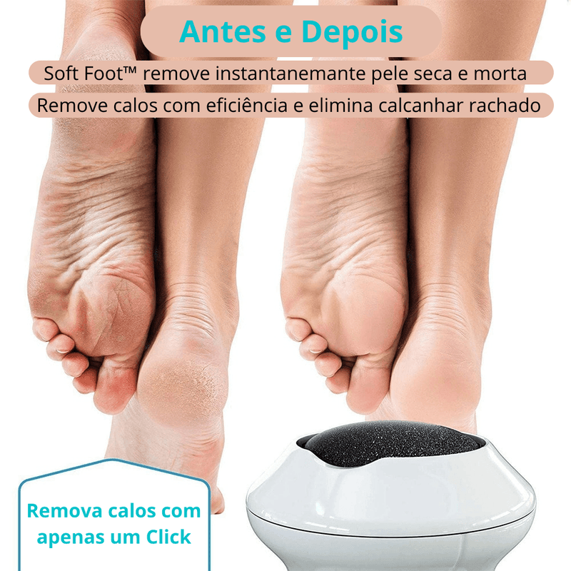 Removedora de Calos e Rachaduras dos Pés SOFT FOOT + Refil - Inov&tec